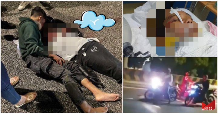 Motosikal dilarikan, tangan gadis mangsa samun tengah jalan terpaksa dipotong