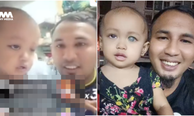 Bayi hidap kanser mata tahap 4