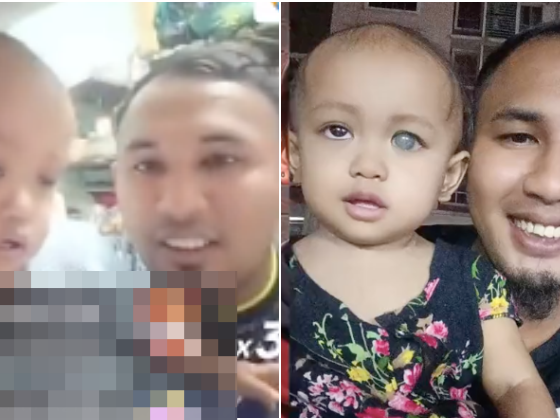 Bayi hidap kanser mata tahap 4