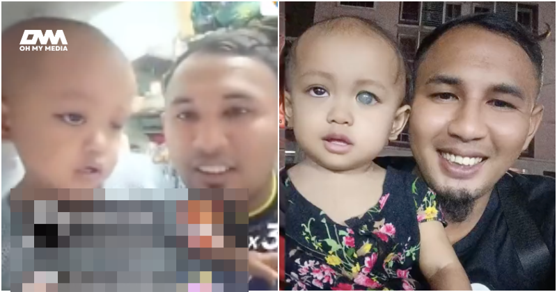 Bayi hidap kanser mata tahap 4