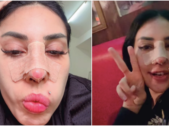 Zarina Anjoulie buat hidung untuk beri kesedaran