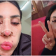 Zarina Anjoulie buat hidung untuk beri kesedaran