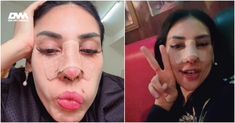 Zarina Anjoulie buat hidung untuk beri kesedaran