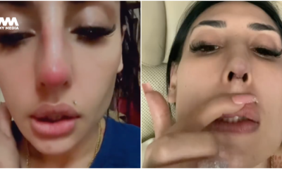 Zarina Anjoulie menyesal buat hidung