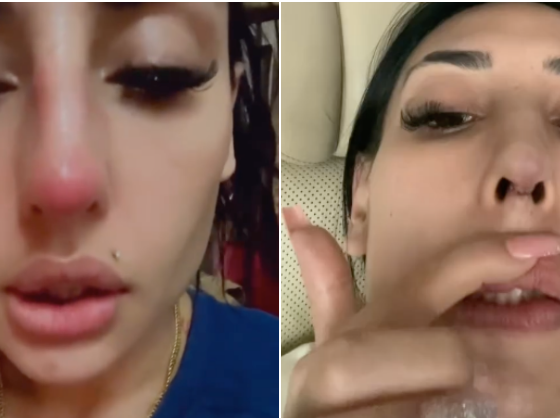 Zarina Anjoulie menyesal buat hidung