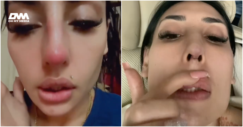 Zarina Anjoulie menyesal buat hidung