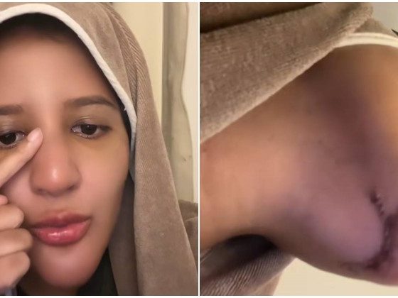 Isteri Azlan Komeng terseksa buang silikon
