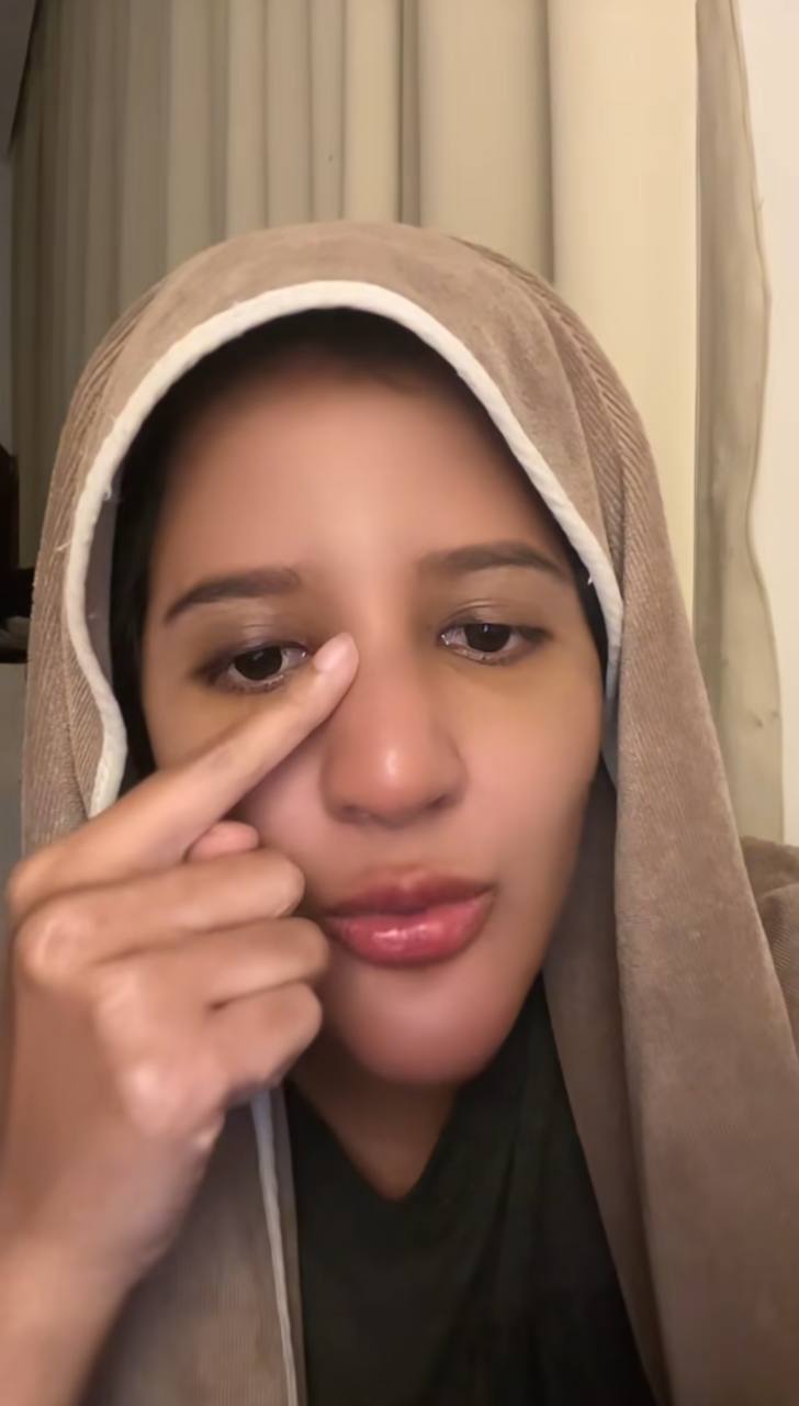 Isteri Azlan Komeng terseksa buang silikon