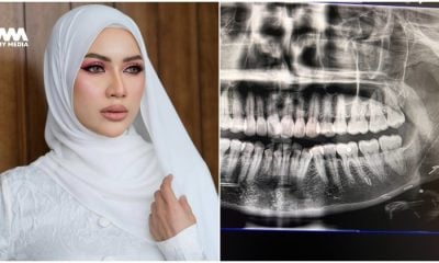 Doktor sangka pakai susuk
