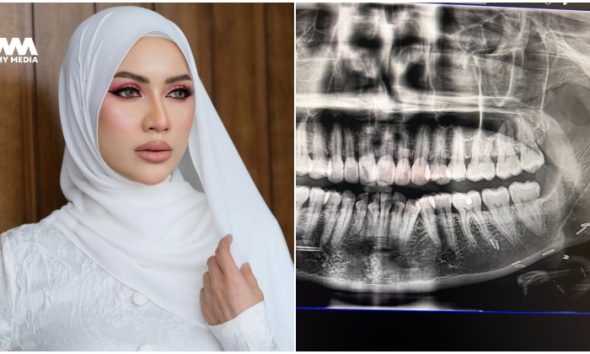 Doktor sangka pakai susuk