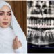 Doktor sangka pakai susuk