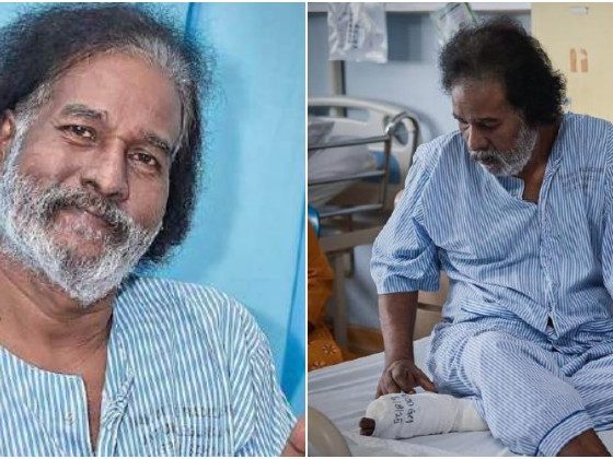 Sathiya lega dua jari berjaya diselamatkan
