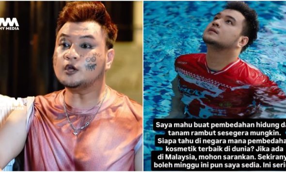 Iqbal Zulkefli serius mahu buat pembedahan