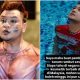 Iqbal Zulkefli serius mahu buat pembedahan