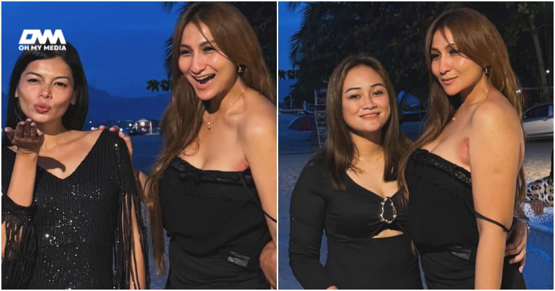 Bukan kurap! Kak KM perjelas, ketiak kemerahan angkara cuba produk tiruan Bukan kurap! Kak KM perjelas, ketiak kemerahan angkara cuba produk tiruan