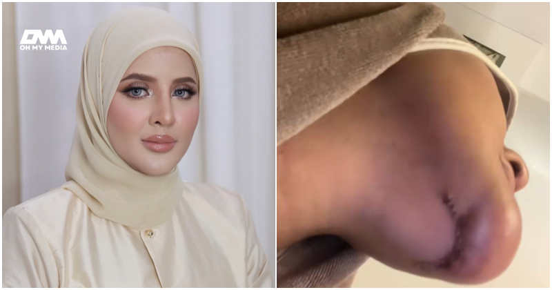 Sanggup buang silikon dan tatu, Nilam Ortiz mahu bersih menghadap Tuhan – “Cuba jadi baik” Sanggup buang silikon dan tatu, Nilam Ortiz mahu bersih menghadap Tuhan – “Cuba jadi baik”